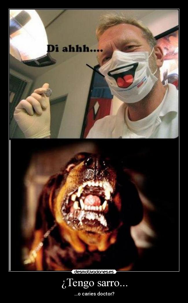 ¿Tengo sarro... - ...o caries doctor?