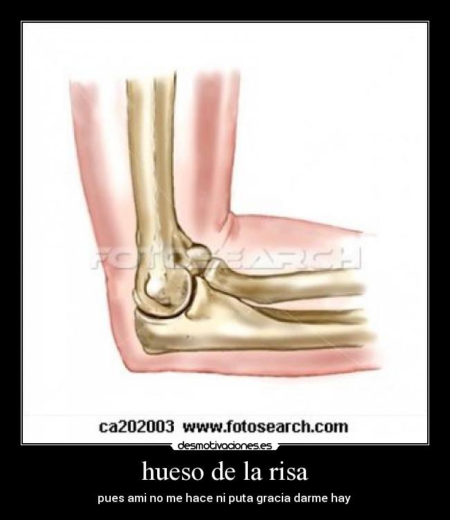 carteles risa hueso desmotivaciones