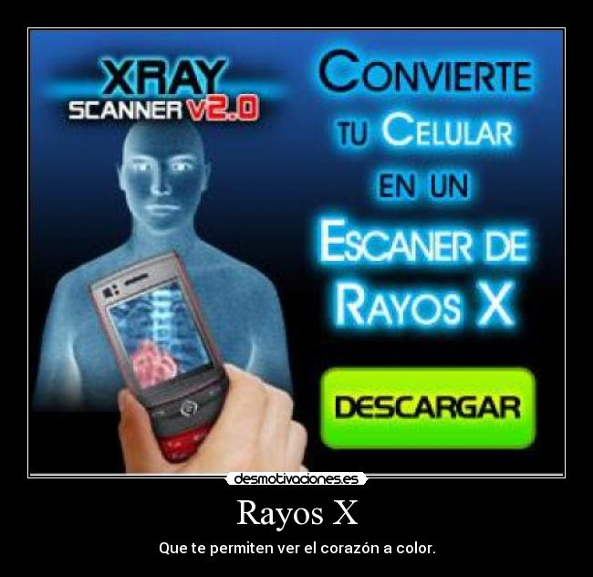 Rayos X -