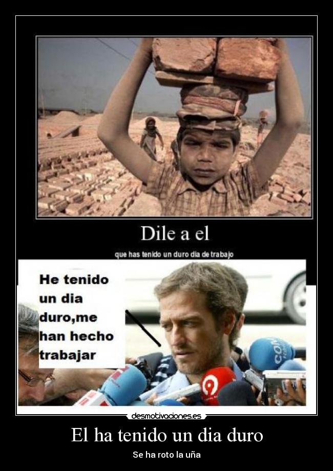 El ha tenido un dia duro - Se ha roto la uña