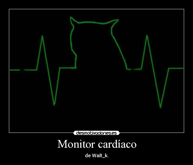 Monitor cardíaco - de Walt_k.