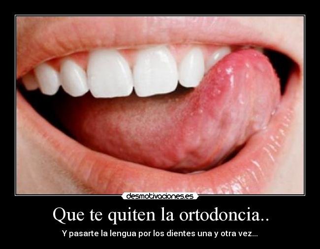Que te quiten la ortodoncia.. - Y pasarte la lengua por los dientes una y otra vez...