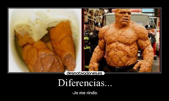 Diferencias... -