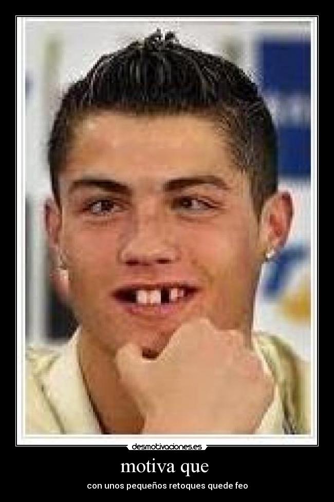 motiva que - con unos pequeños retoques quede feo