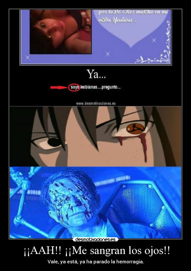 ¡¡AAH!! ¡¡Me sangran los ojos!! -