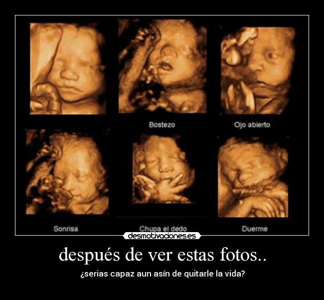 después de ver estas fotos.. -