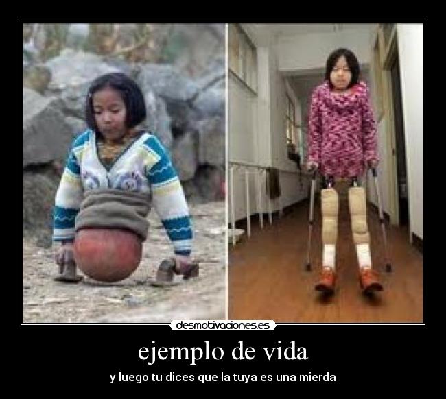 ejemplo de vida - y luego tu dices que la tuya es una mierda