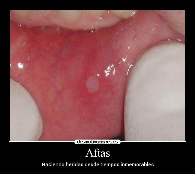 Aftas - 