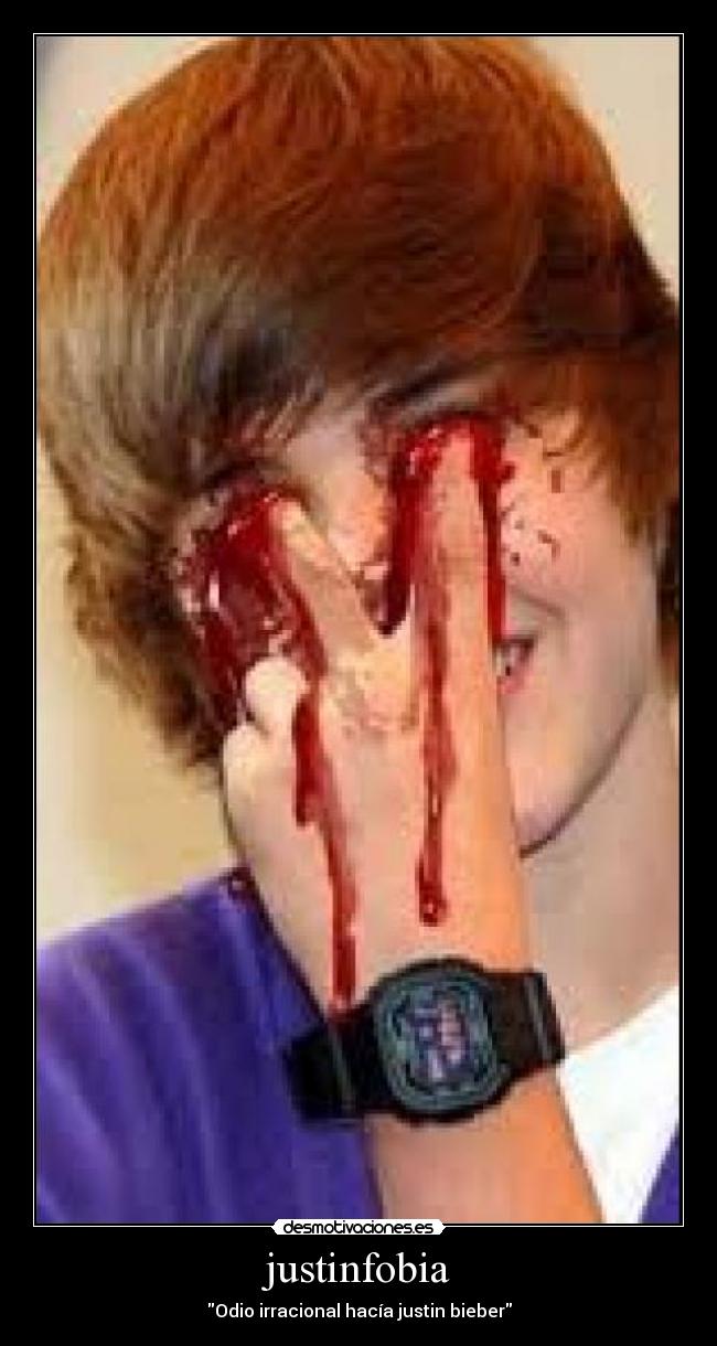 justinfobia -