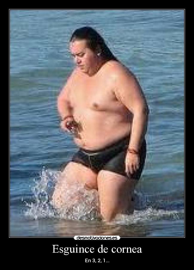 Esguince de cornea -