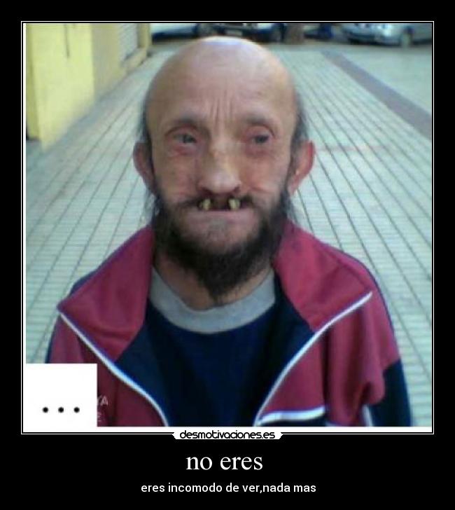 no eres - eres incomodo de ver,nada mas