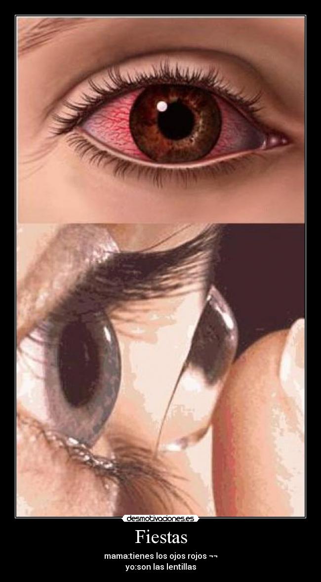 carteles lentillas desmotivaciones