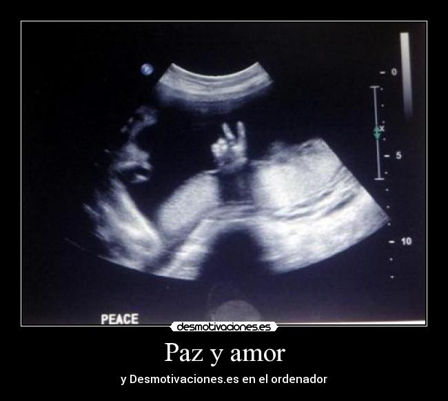 Paz y amor - 