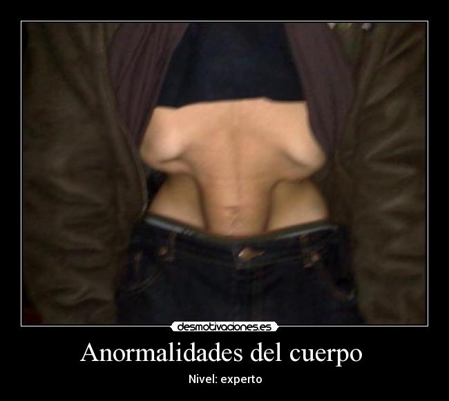 carteles anormalidades del cuerpo desmotivaciones