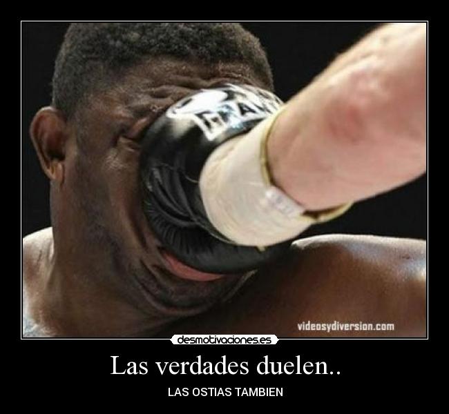 Las verdades duelen.. - 