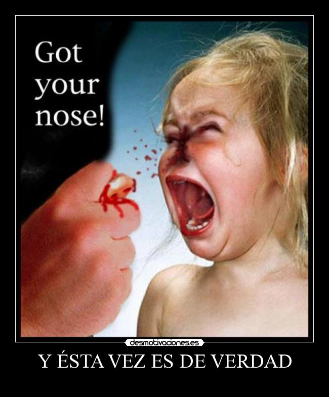 Y ÉSTA VEZ ES DE VERDAD -