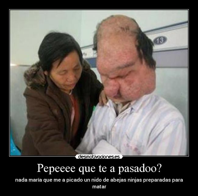 Pepeeee que te a pasadoo? - nada maría que me a picado un nido de abejas ninjas preparadas para matar