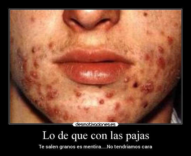 Lo de que con las pajas - Te salen granos es mentira.....No tendriamos cara