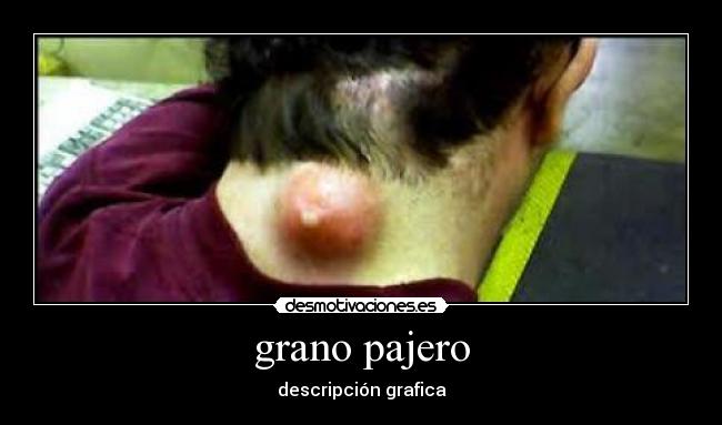 grano pajero - descripción grafica