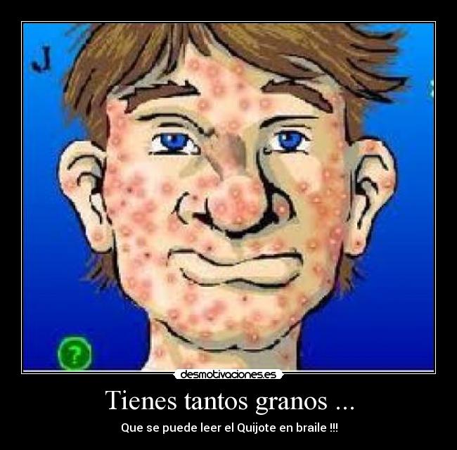 Tienes tantos granos ... - Que se puede leer el Quijote en braile !!!