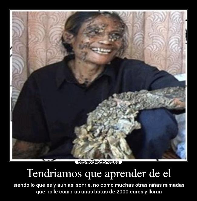 Tendriamos que aprender de el - siendo lo que es y aun asi sonrie, no como muchas otras niñas mimadas
que no le compras unas botas de 2000 euros y lloran