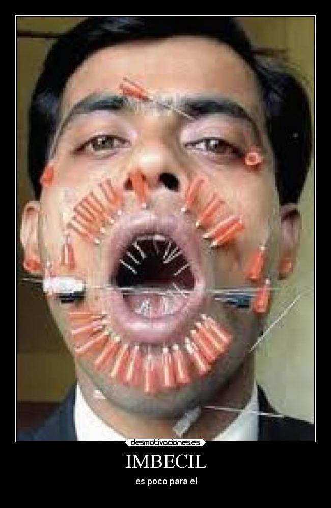 IMBECIL - es poco para el