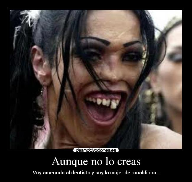 Aunque no lo creas - Voy amenudo al dentista y soy la mujer de ronaldinho...
