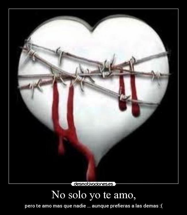 No solo yo te amo, -
