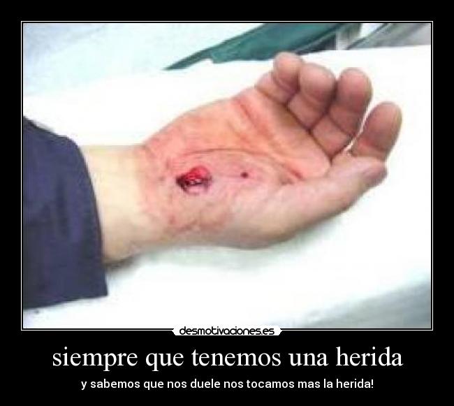 siempre que tenemos una herida - y sabemos que nos duele nos tocamos mas la herida!