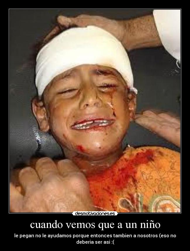 cuando vemos que a un niño - le pegan no le ayudamos porque entonces tambien a nosotros (eso no
deberia ser asi :(