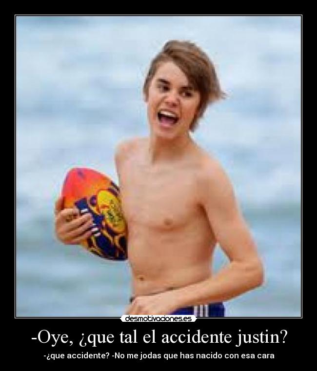 -Oye, ¿que tal el accidente justin? - 