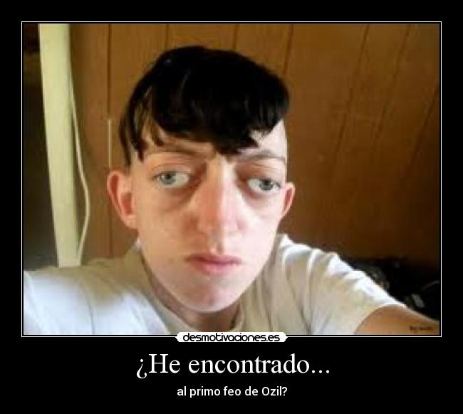 ¿He encontrado... - al primo feo de Ozil?