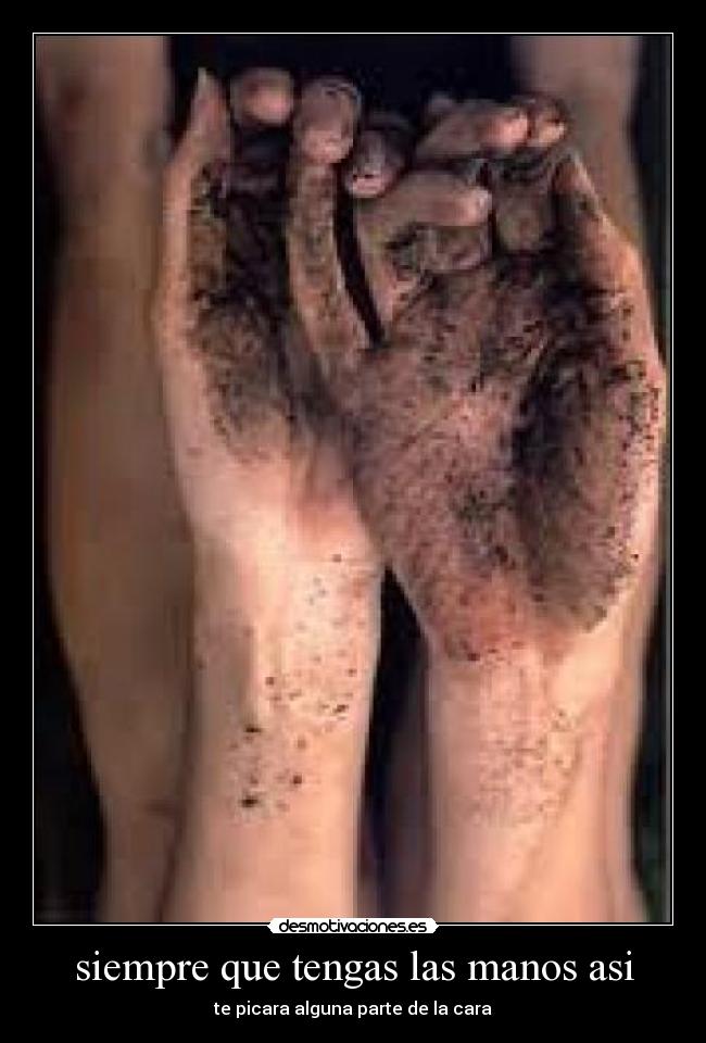 siempre que tengas las manos asi -