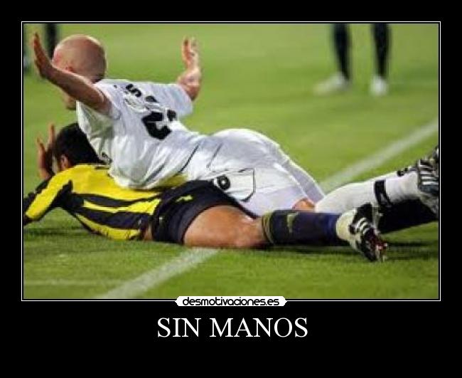 SIN MANOS -