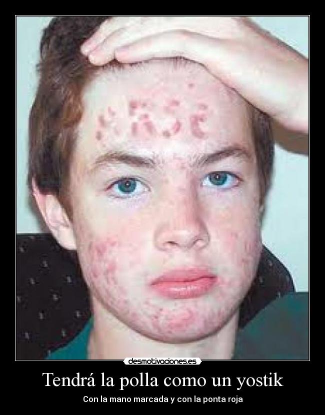 Tendrá la polla como un yostik -