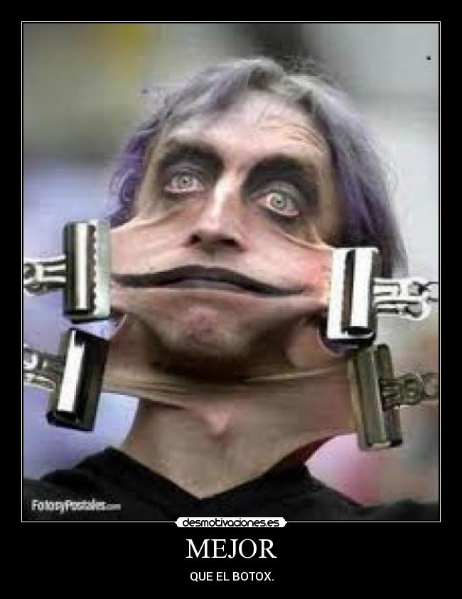 MEJOR - QUE EL BOTOX.