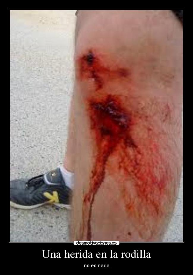 carteles herida desmotivaciones
