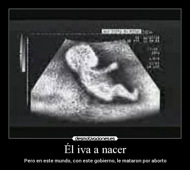 Él iva a nacer - Pero en este mundo, con este gobierno, le mataron por aborto