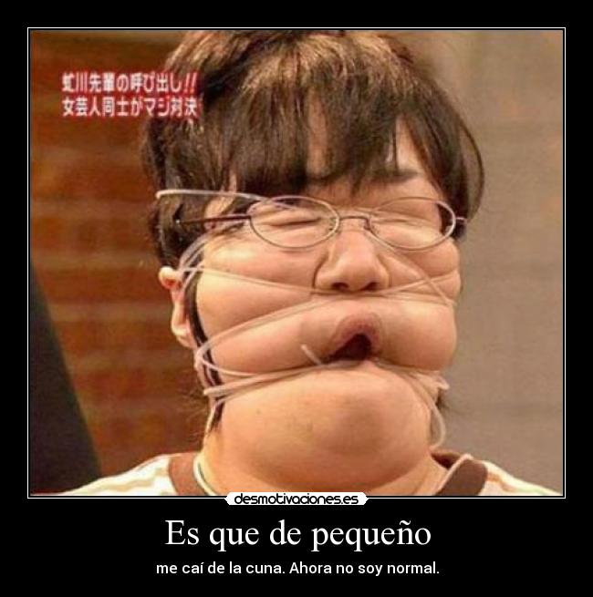 Es que de pequeño - me caí de la cuna. Ahora no soy normal.