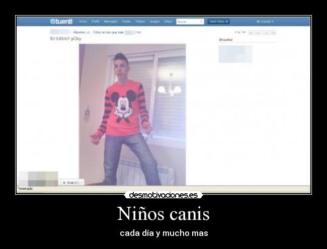 Niños canis - 