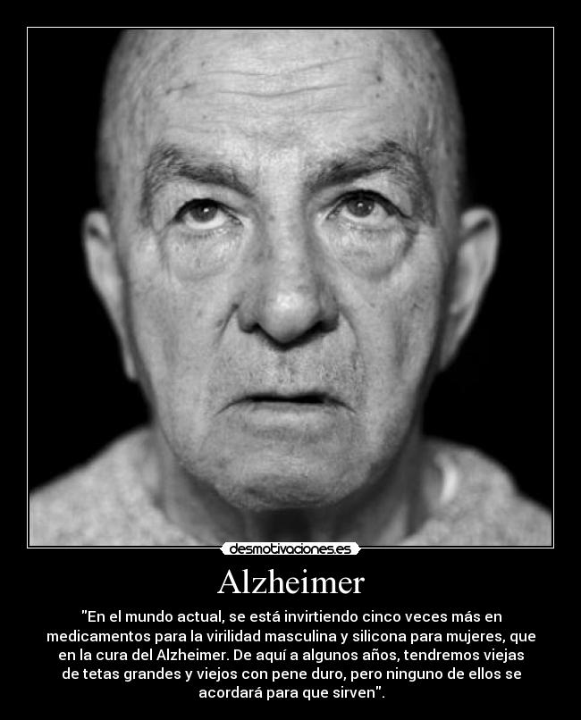 Alzheimer - 