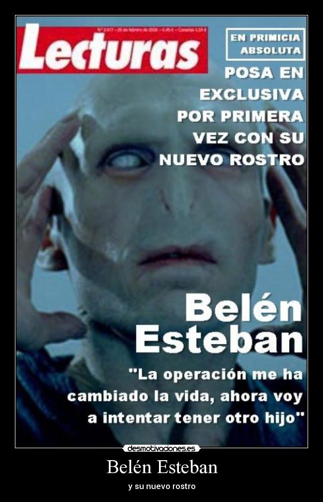 Belén Esteban - y su nuevo rostro