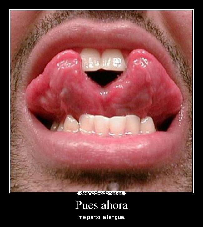 Pues ahora - me parto la lengua.