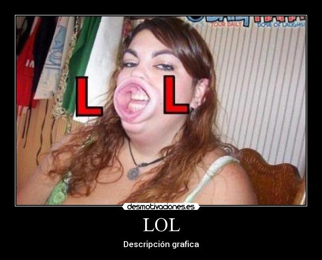 LOL -
