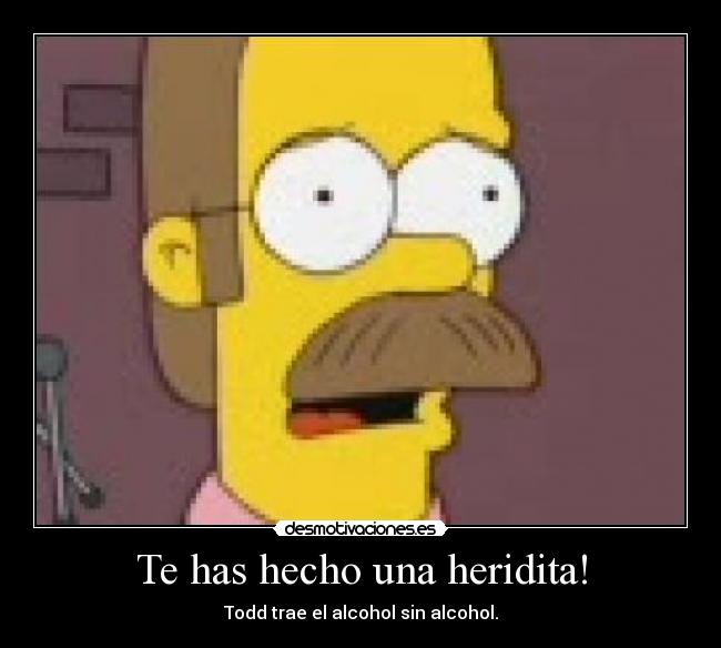 Te has hecho una heridita! - Todd trae el alcohol sin alcohol.