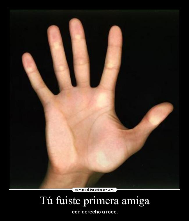 Tú fuiste primera amiga - con derecho a roce.