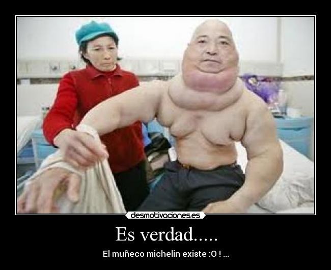 Es verdad..... -