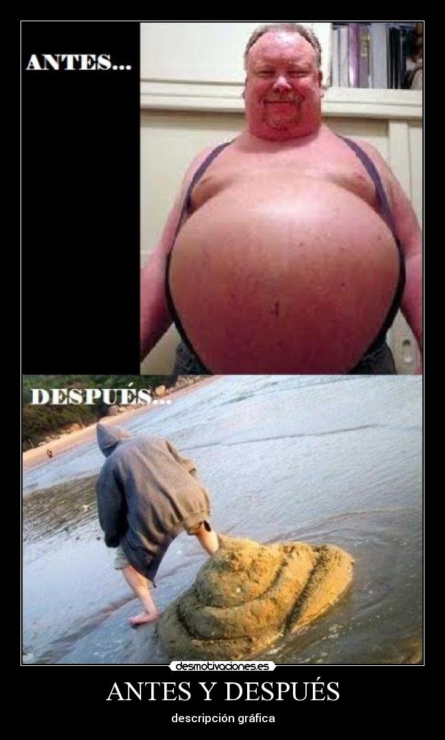 ANTES Y DESPUÉS -