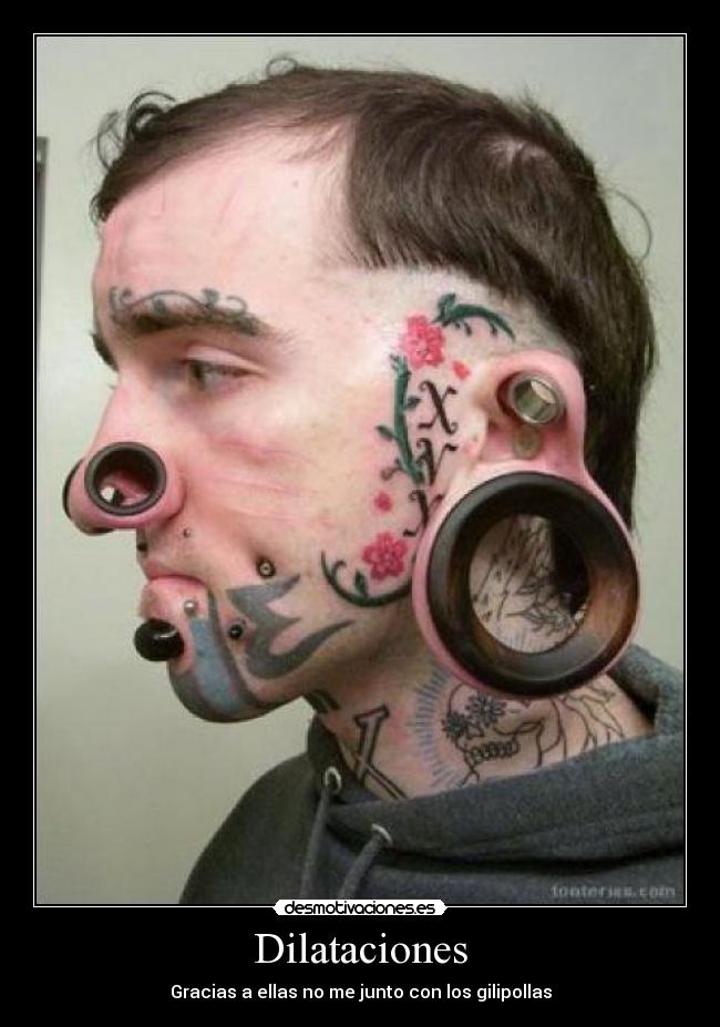 Dilataciones - Gracias a ellas no me junto con los gilipollas