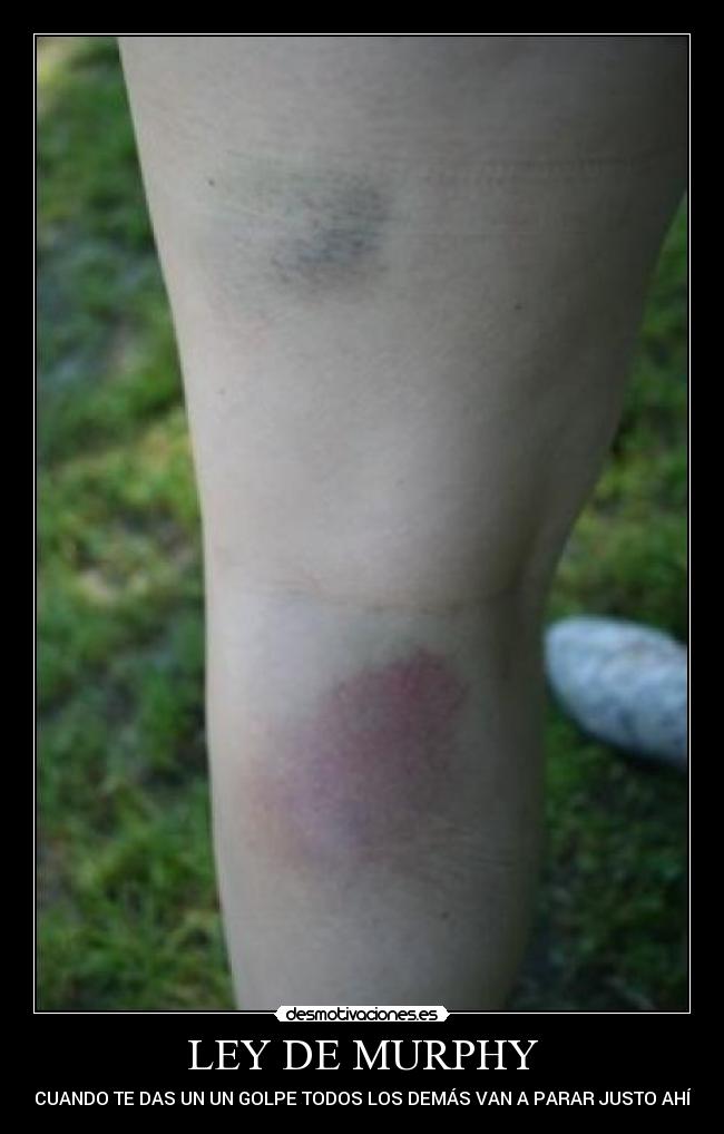 LEY DE MURPHY - CUANDO TE DAS UN UN GOLPE TODOS LOS DEMÁS VAN A PARAR JUSTO AHÍ